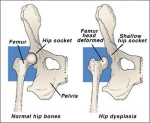 Femoral Head and Neck Ostectomy (FHO) Surgery in Dogs